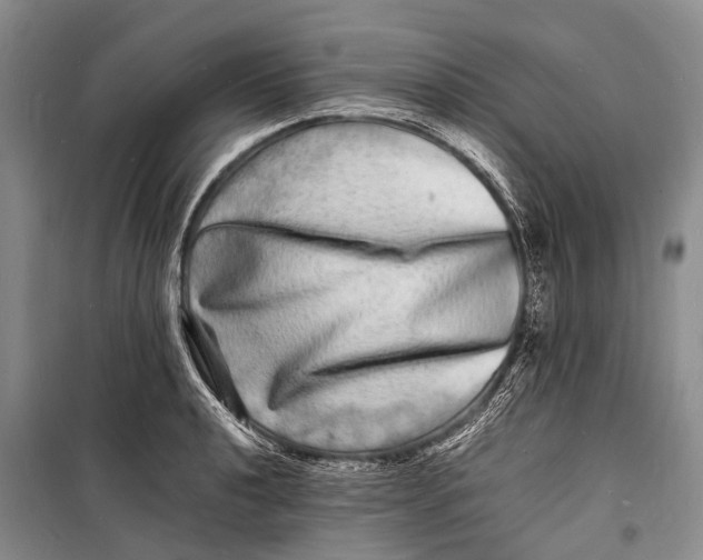 X0000098181040200805151136