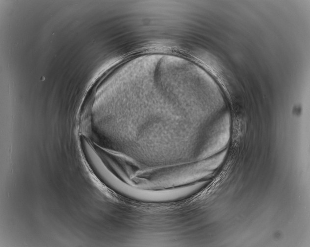 X0000098181042200805151136