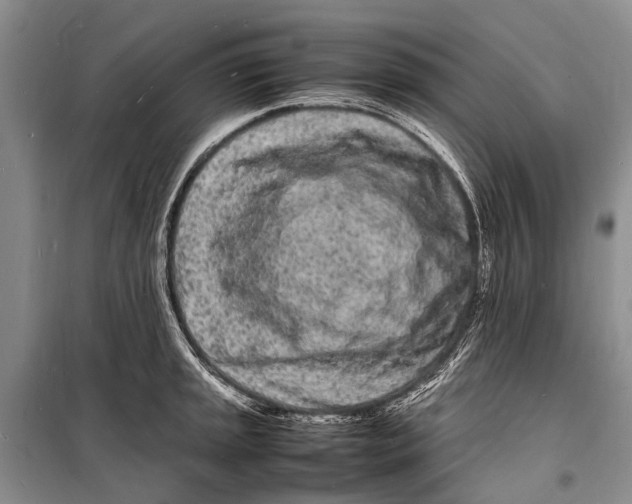 X0000098181045200805151136