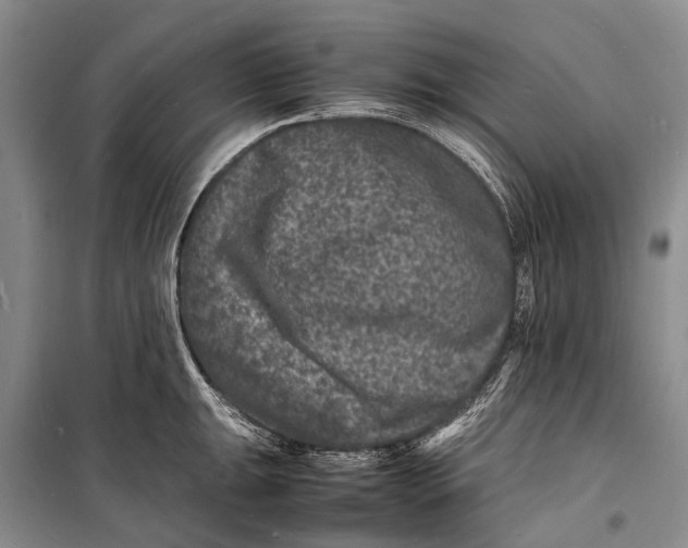 X0000098181047200805151136