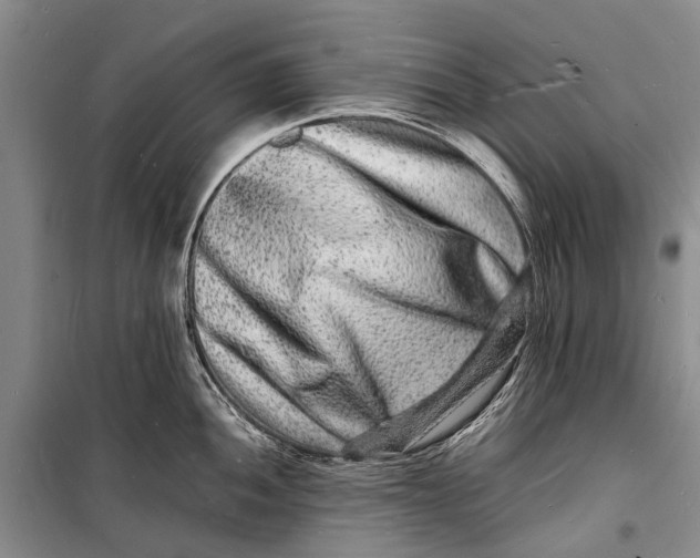 X0000098181052200805151136