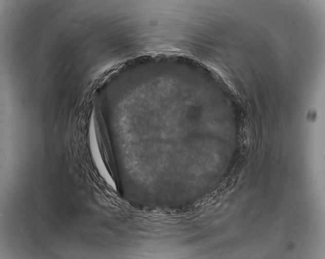 X0000098181063200805151135