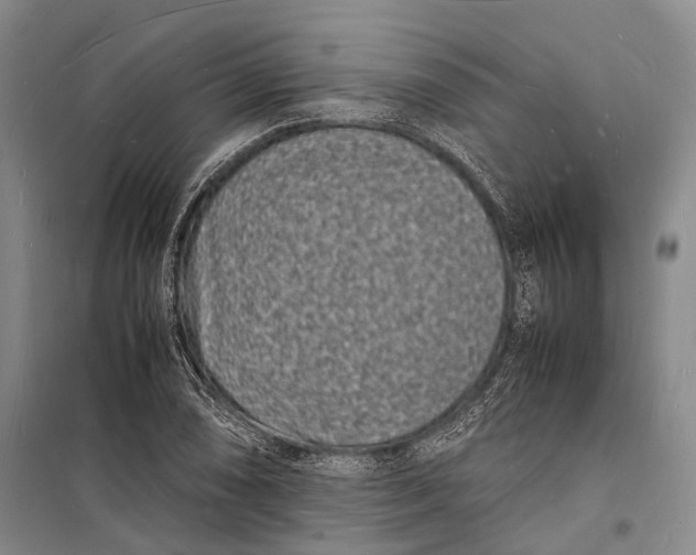 X0000098181074200805151135