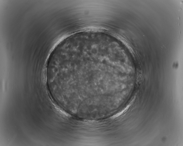 X0000098181075200805151135