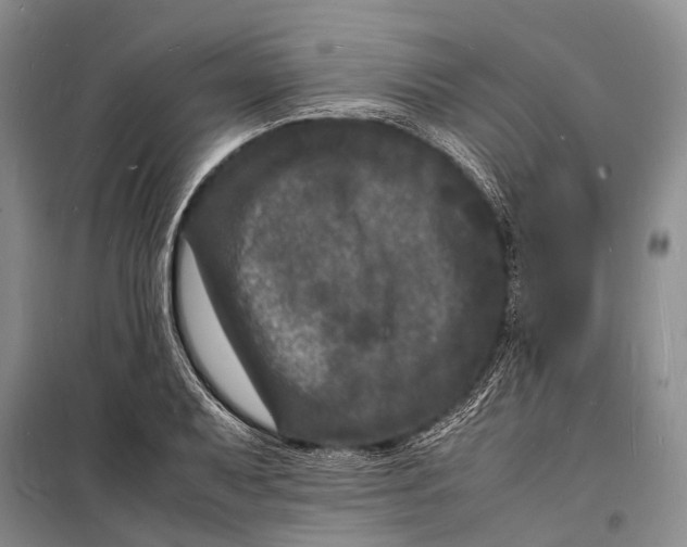 X0000098181079200805151135