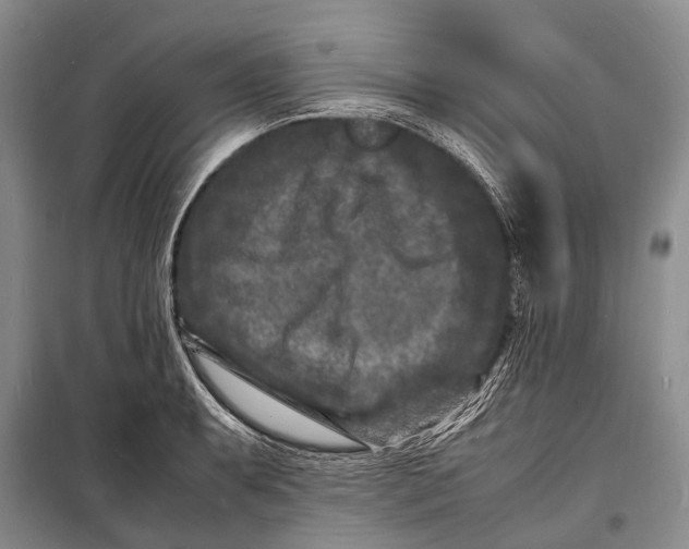 X0000098181087200805151135