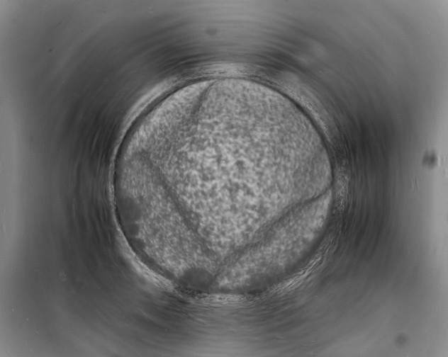 X0000098181090200805151135