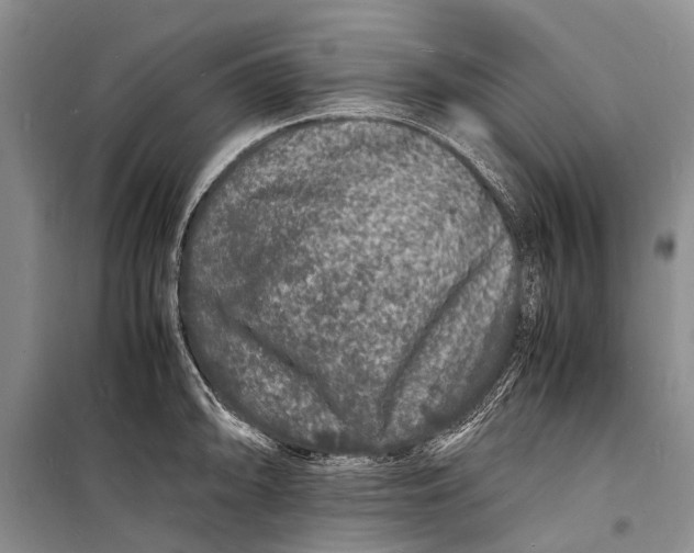 X0000098181094200805151135