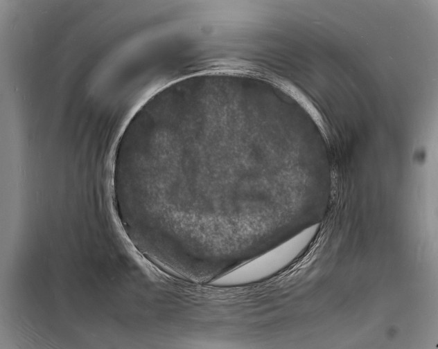 X0000098181099200805151135