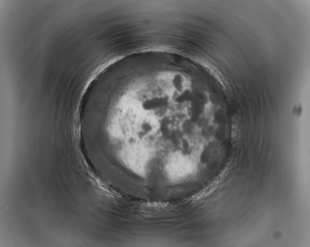 X0000098181117200805151134