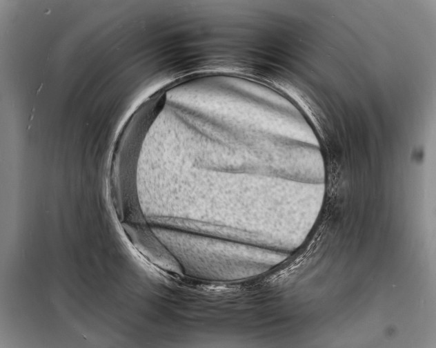 X0000098181139200805151134