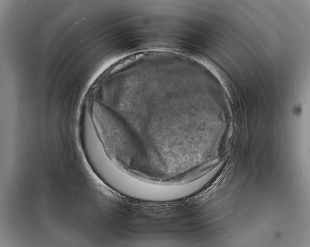 X0000098181147200805151134