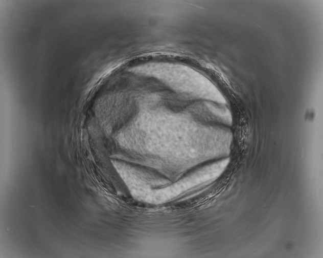 X0000098181159200805151134