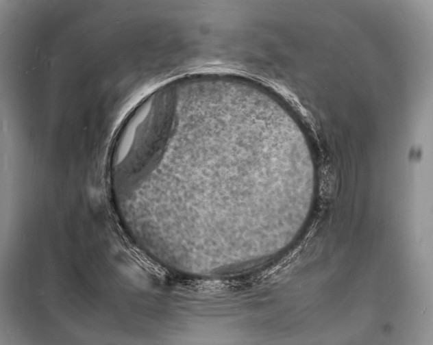 X0000098181167200805151133