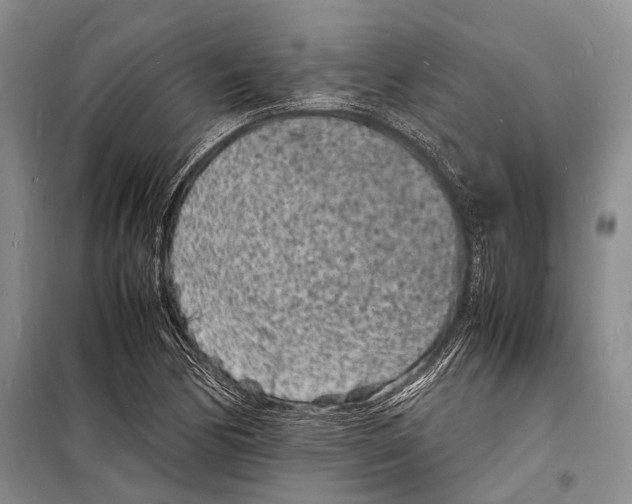 X0000098181170200805151133