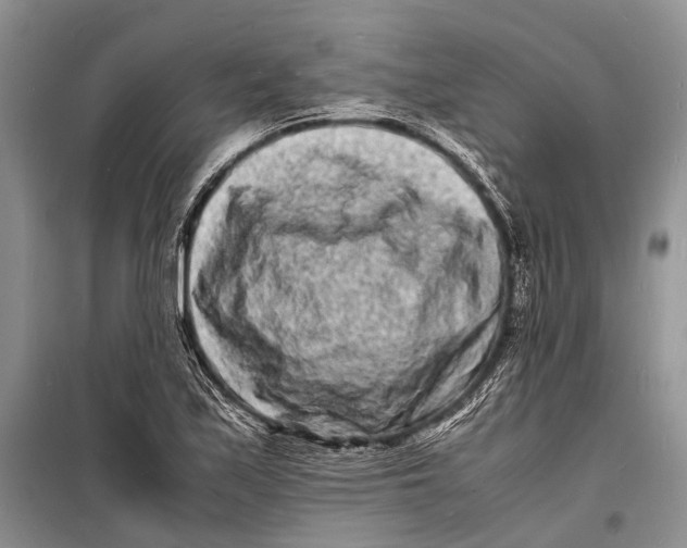 X0000098181171200805151133