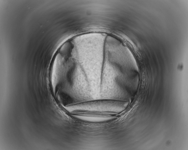 X0000098181182200805151133