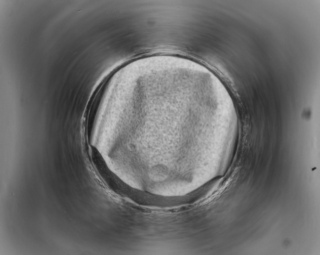 X0000098181190200805151133