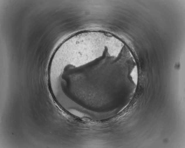 X0000098181191200805151133