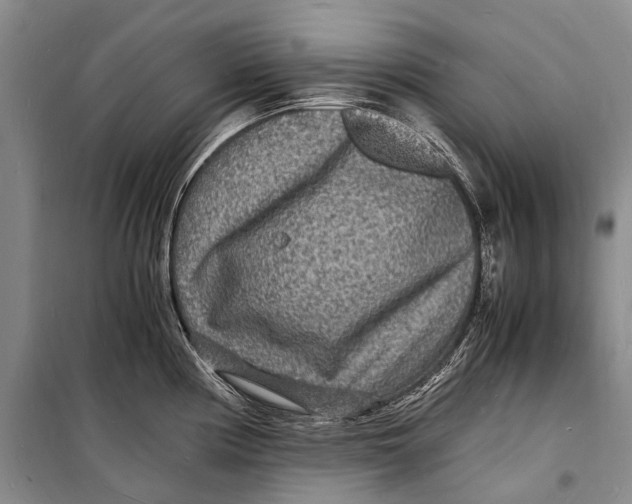 X0000098181194200805151133