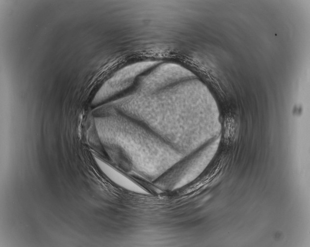 X0000098181202200805151132