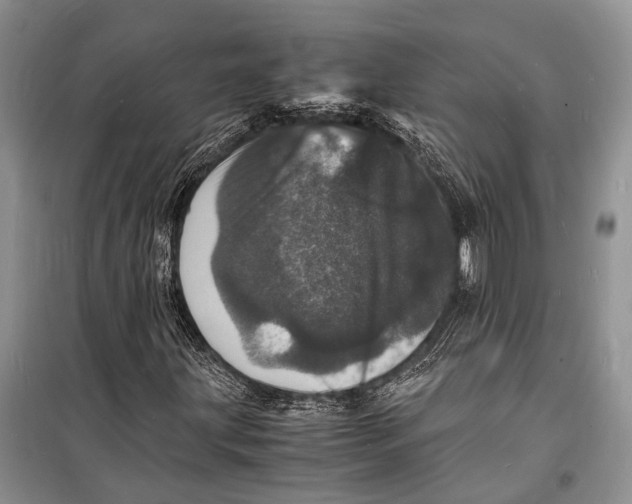 X0000098181203200805151132