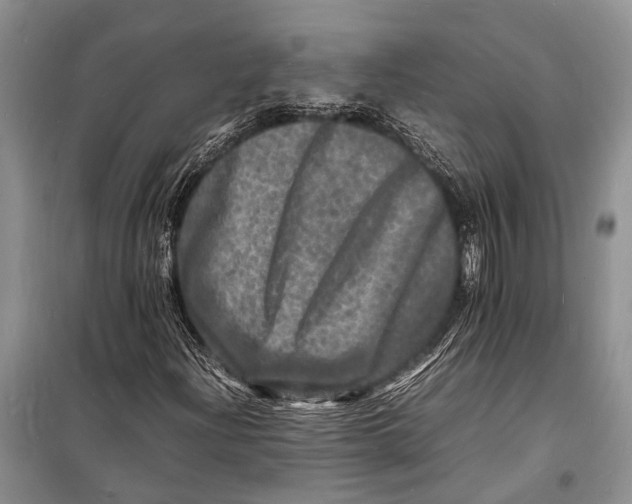 X0000098181204200805151132