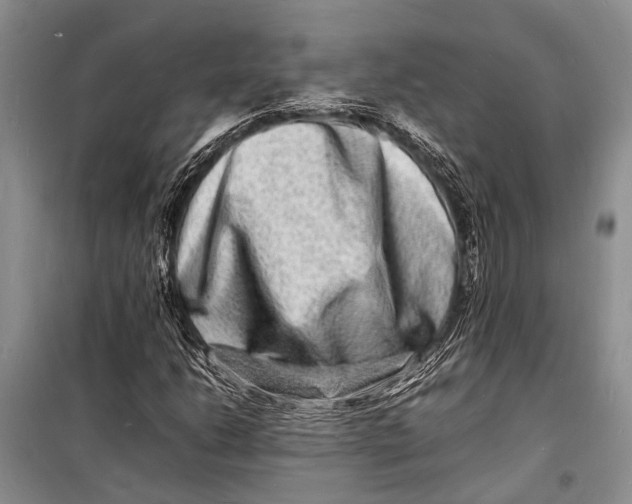 X0000098181206200805151132