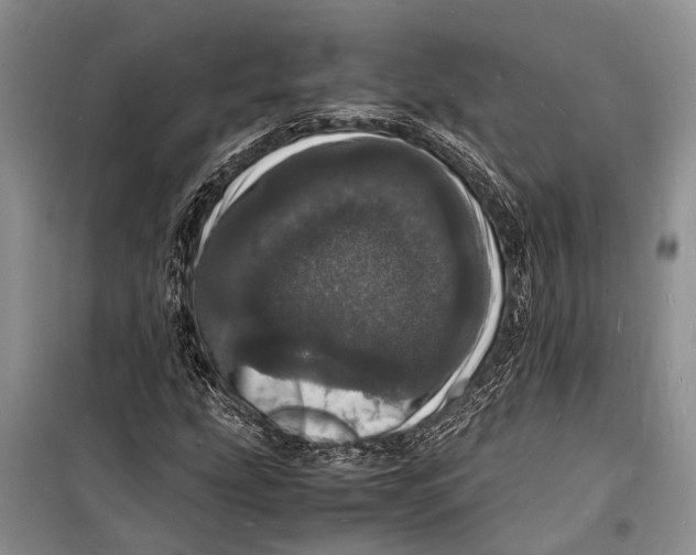 X0000098181207200805151132