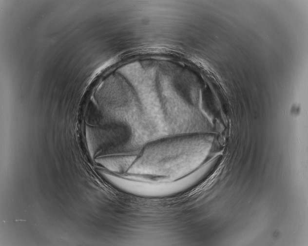 X0000098181210200805151132