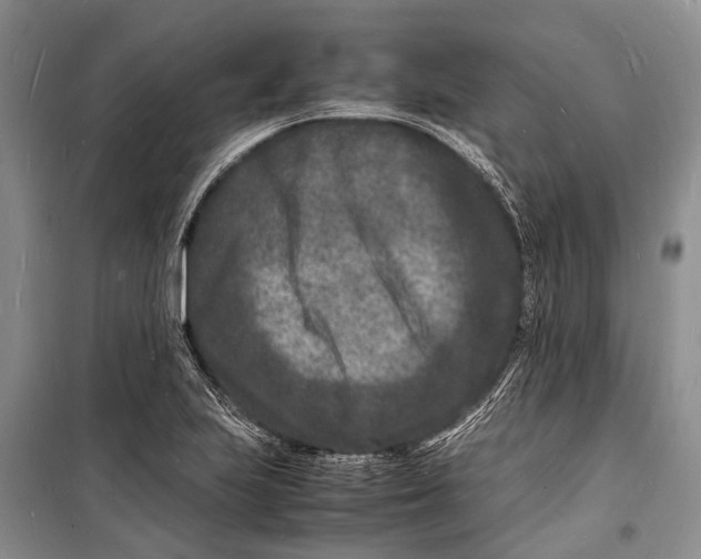 X0000098181223200805151133