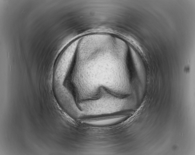 X0000098181228200805151133