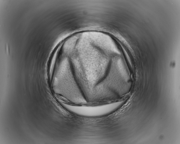 X0000098181230200805151133