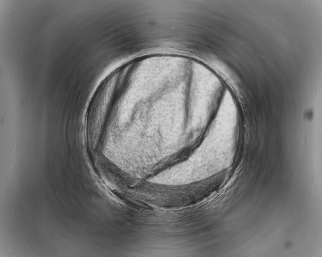 X0000098181238200805151133