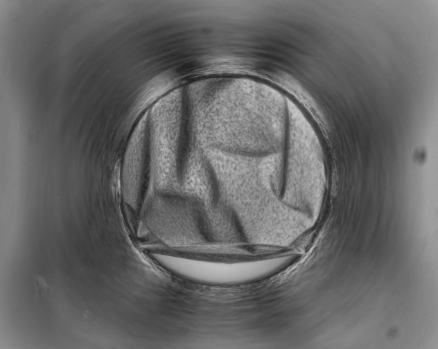 X0000098181241200805151133