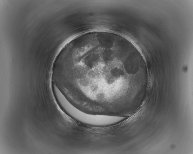 X0000098181245200805151133