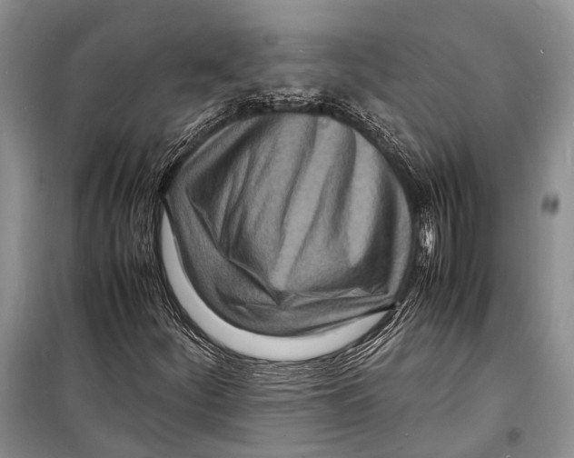 X0000098181252200805151132