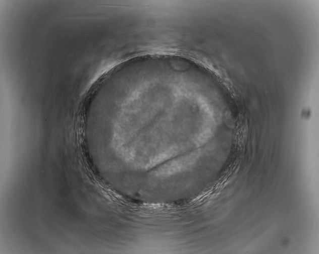 X0000098181255200805151132