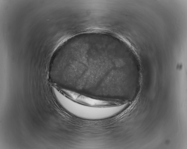 X0000098181259200805151132