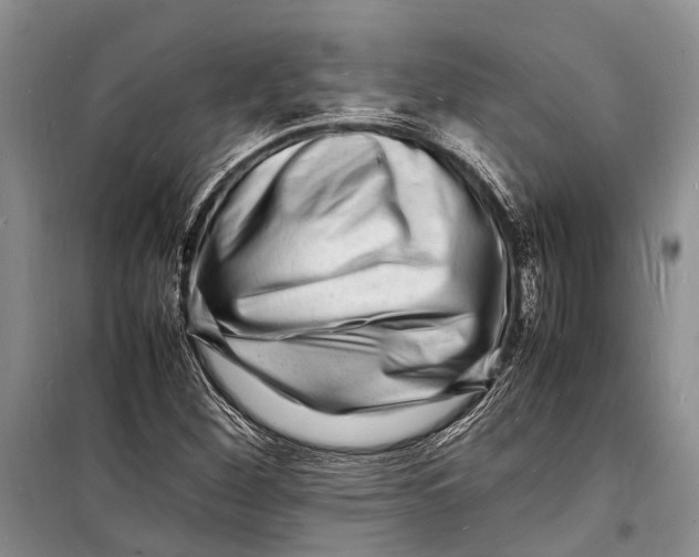 X0000098181260200805151132