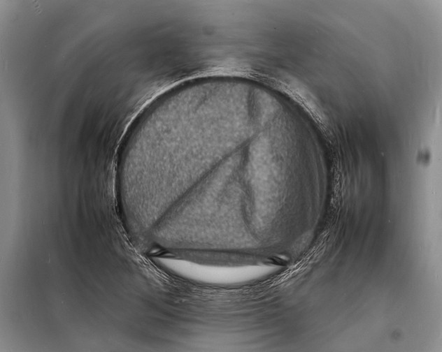 X0000098181268200805151132