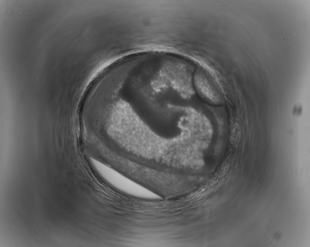 X0000098181271200805151132