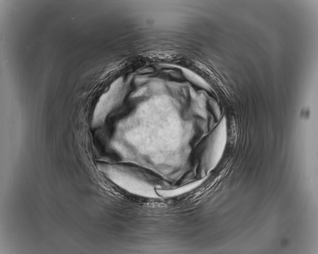 X0000098181297200805151131