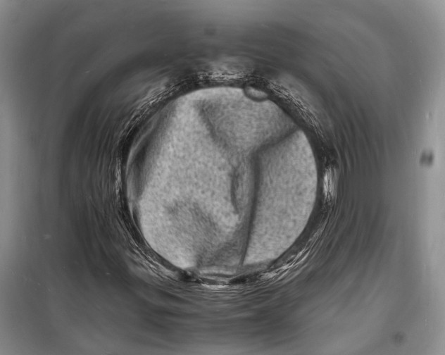 X0000098181299200805151131