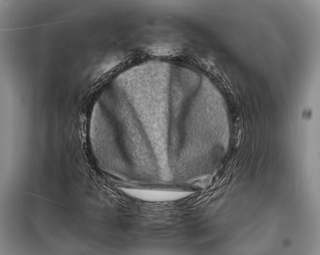 X0000098181301200805151131