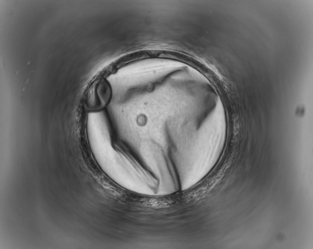 X0000098181311200805151131