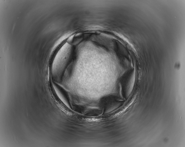 X0000098181317200805151131