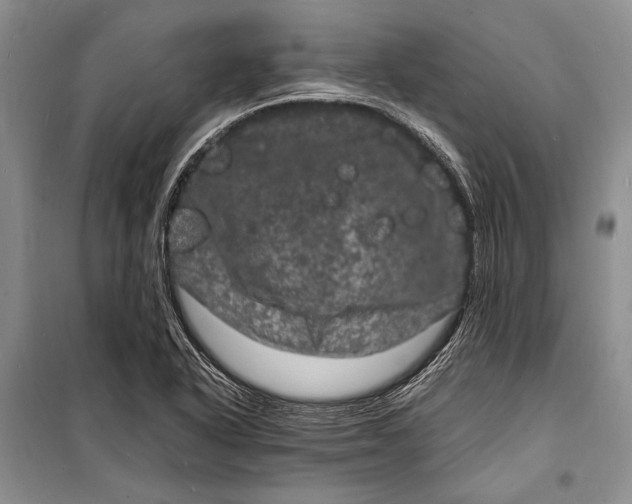 X0000098181318200805151131