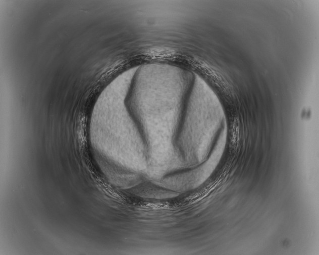 X0000098181346200805151131