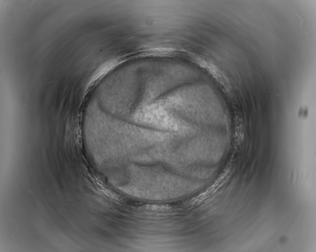 X0000098181354200805151131